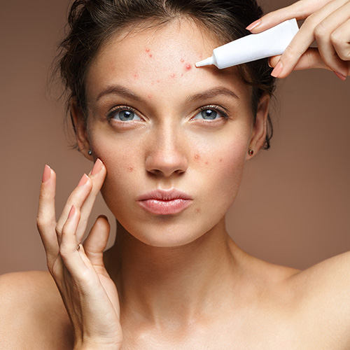 Skincare Do's and Don'ts - Do you use a spot treatment instead of squeezing your pimples