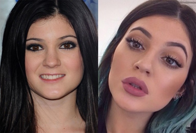 Celeb plastic surgery- before and after — Beauty News Australia