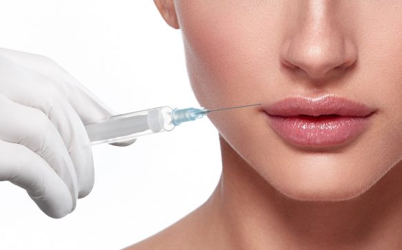 5 things you need to know about lip fillers