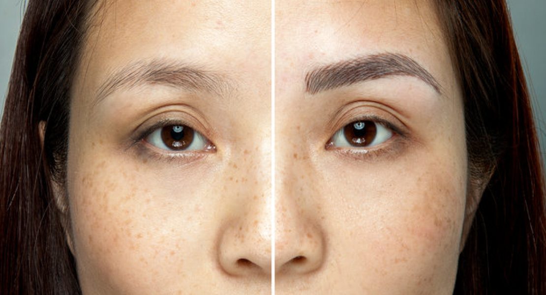 What You Should Know About Microblading